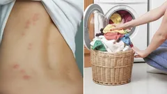 Periete nesprávne: Pri akej teplote skutočne hynú roztoče prachu?